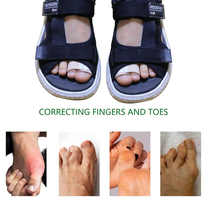 Fabric Hammer Toe Wraps - Correct Overlapping, Crooked, and Curled Toes