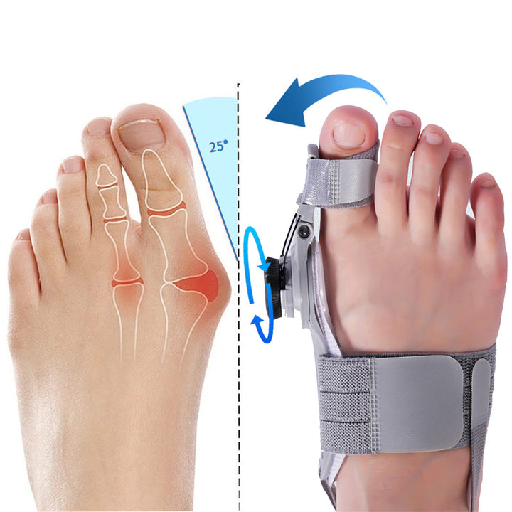 esLife Orthopedic Bunion Corrector - Relieve Pain and Realign Toes